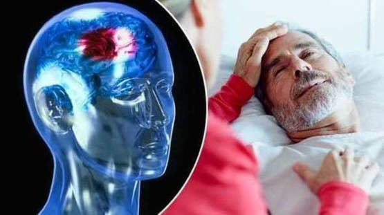 مستشفيات سوهاج الجامعية تعالج 20 حالة سكتة دماغية حادة بنجاح