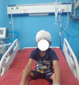 معجزة طبية بسوهاج.. استخراج رصاصة من مخ طفل