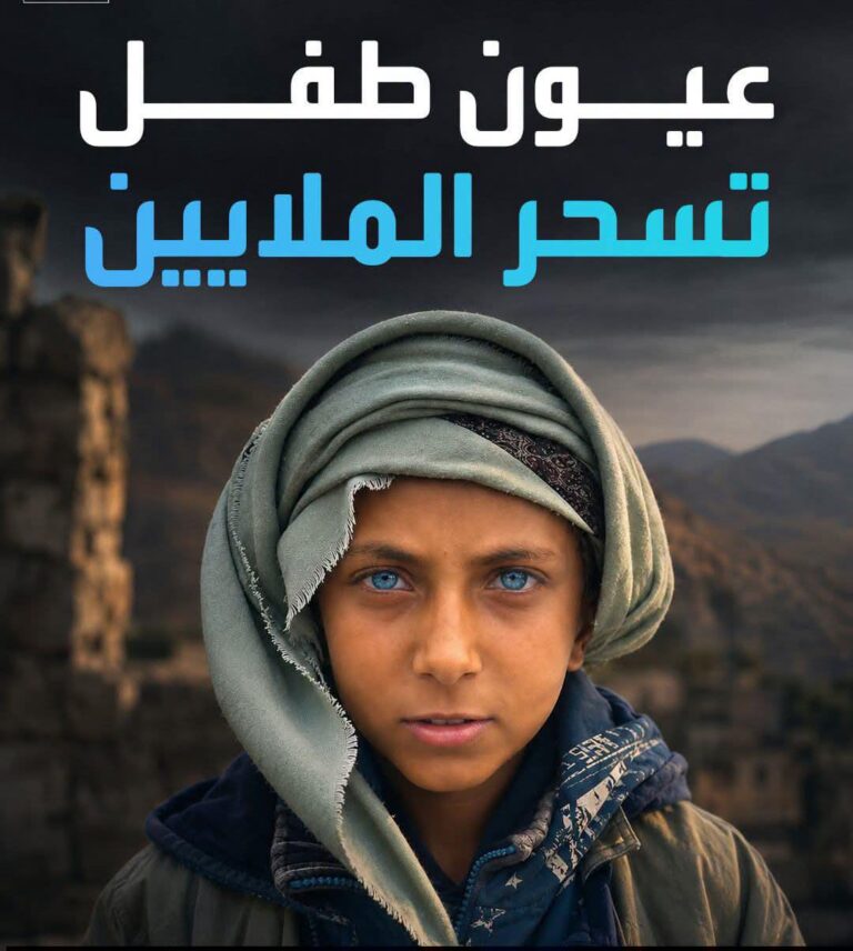 طفل يمني يخطف الأنظار بعيونه الزرقاء.. فيديو يحصد 30 مليون مشاهدة ويحوّله إلى نجم السوشيال ميديا